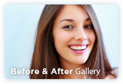 Before an After Gallery